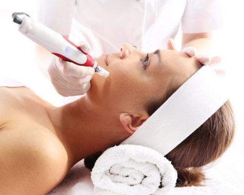 microneedling
