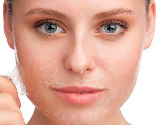 peeling-medico