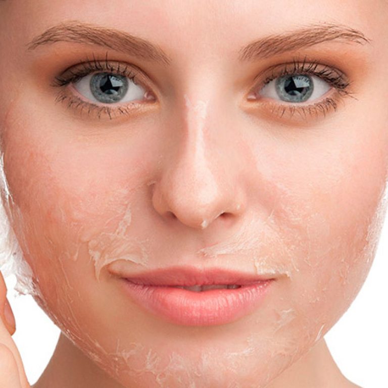 peeling-medico