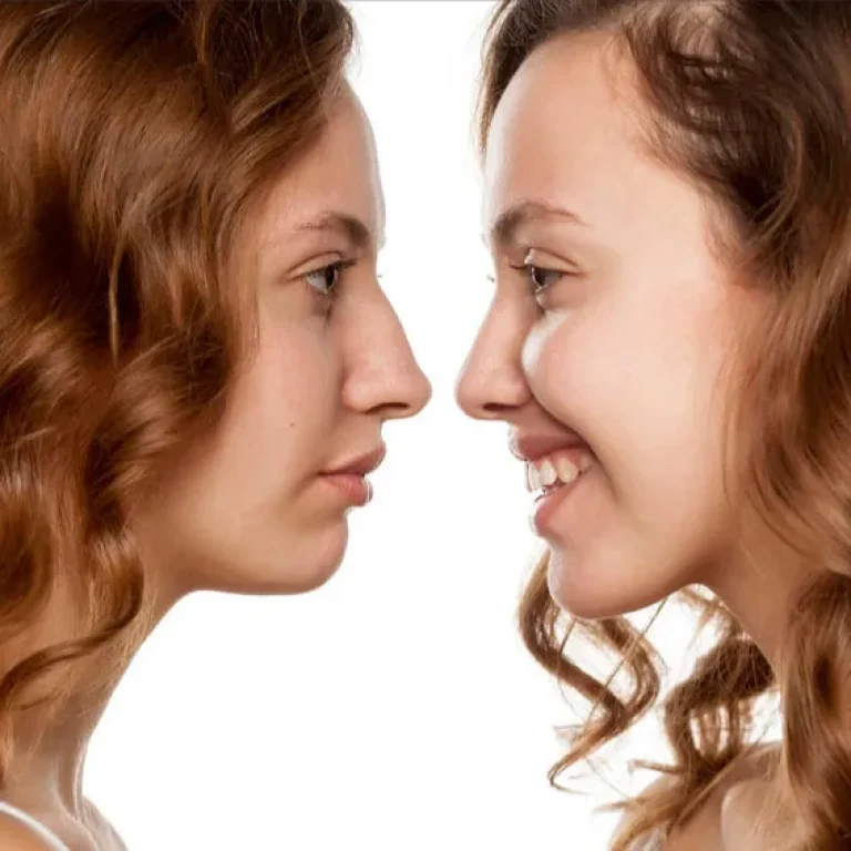 Dos perfiles de mujer frente a frente mostrando el contorno del rostro
