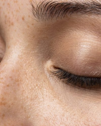 vista-lateral-de-textura-de-piel-de-mujer-joven-min